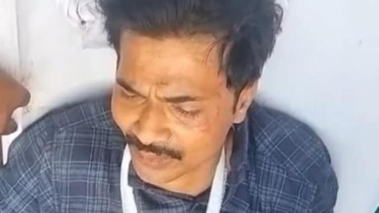 Gonda Crime News दिनदहाड़े युवक पर जानलेवा हमला, हालत गंभीर: कार्रवाई को लेकर उठे सवाल Gonda