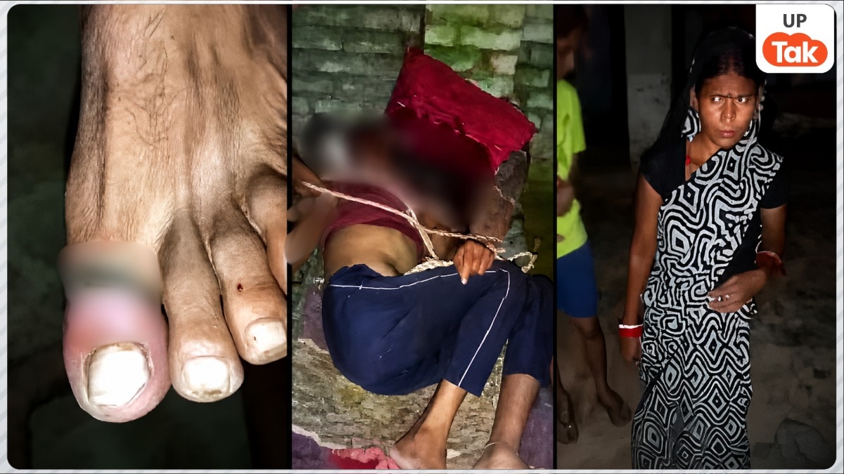 Fatehpur Husband Assault Case
