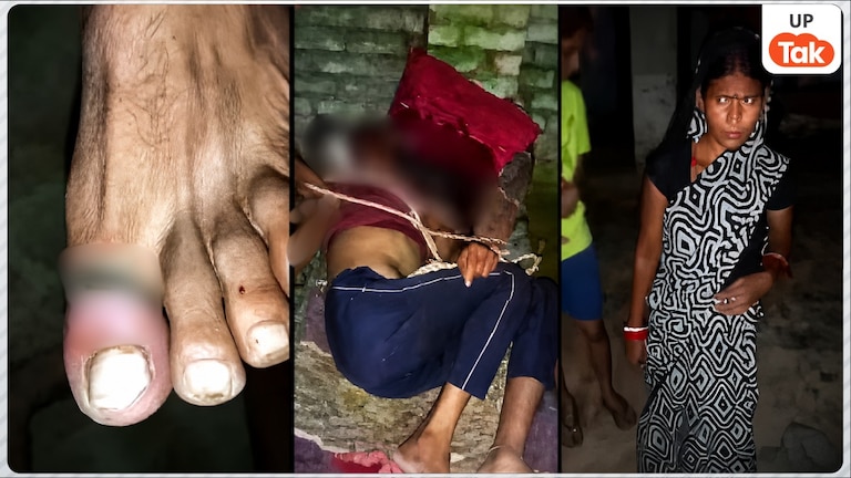 पति को चारपाई में बांधकर दिए करंट के झटके..., फतेहपुर में पत्नी ने संजीव तिवारी को मार-मारकर किया अधमरा, खून से लथपथ मिला युवक Fatehpur Husband Assault Case