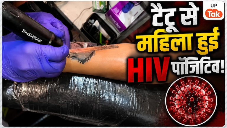 दिल्ली में टैटू बनवाना पड़ा भारी! कानपुर की महिला हुई HIV पॉजिटिव, प्राइवेट पार्ट में इंफेक्शन के बाद पता चली बीमारी Kanpur Woman HIV Positive News