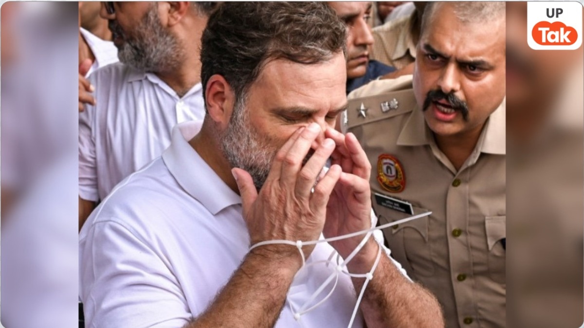 Rahul Gandhi nose injury