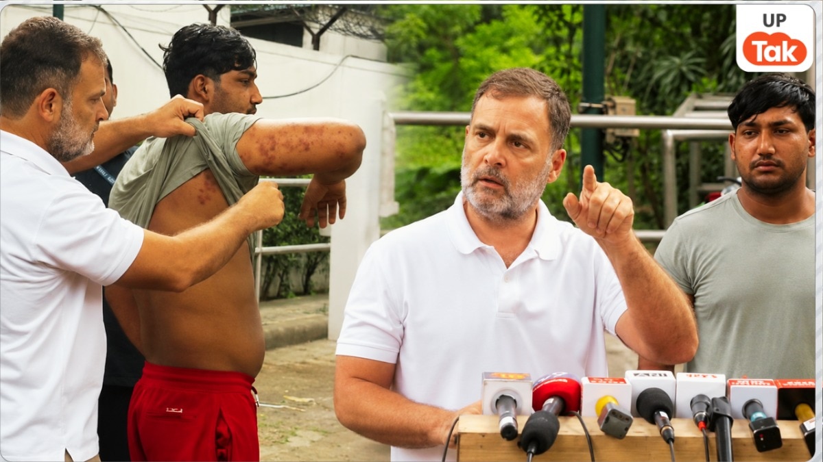 जंतर-मंतर पर हुए बवाल में पुलिस ने चलाई थी पैलेट गन? राहुल गांधी उस युवक को लेकर आ गए सामने जिसकी आंख में लगी चोट