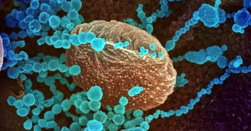 Scientists discover new coronavirus that can transfer from dogs to humans - Vimarsana News