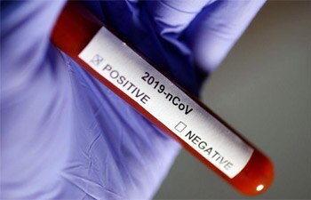 First COVID-19 cases found in Antarctica