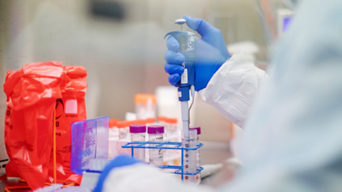 Oxford Coronavirus Vaccine Serum Institute To Begin Phase 3