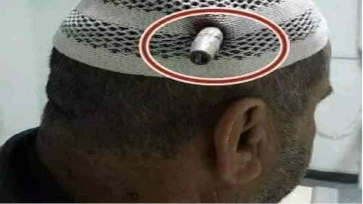 ফ্যাক্ট চেক: বিভ্রান্তিকর দাবী করে ভাইরাল ইরাকি এই ব্যক্তির গুলিবিদ্ধ হওয়ার পুরোনো ছবি