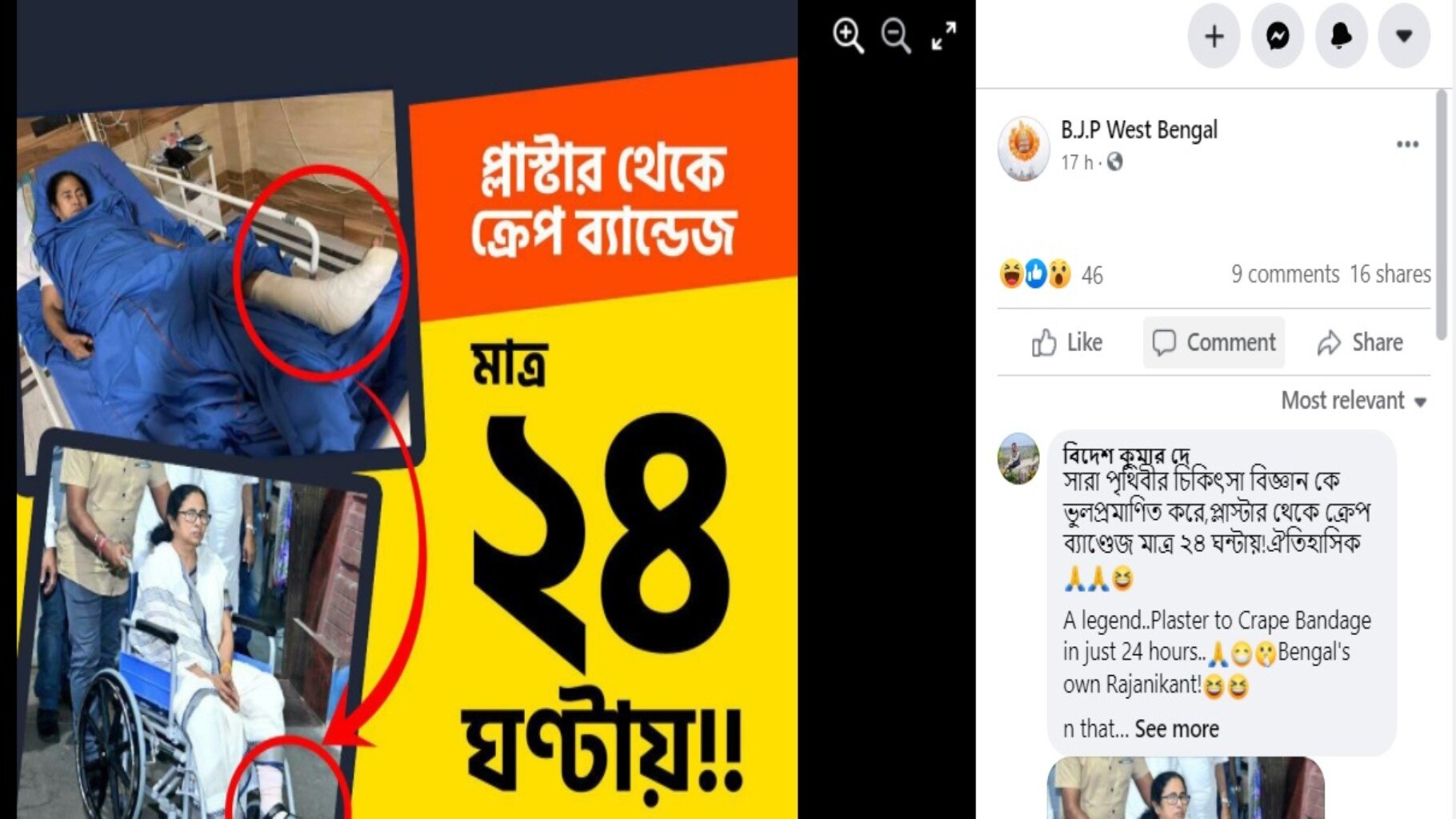 মমতা বন্দ্যোপাধ্যায় প্লাষ্টার করা অবস্থায় এসএসকেএম থেকে মুক্তি পেয়েছেন