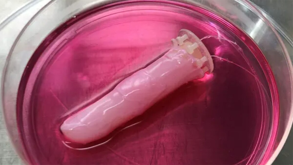 Scientists grow human skin around a robotic finger. Here's how