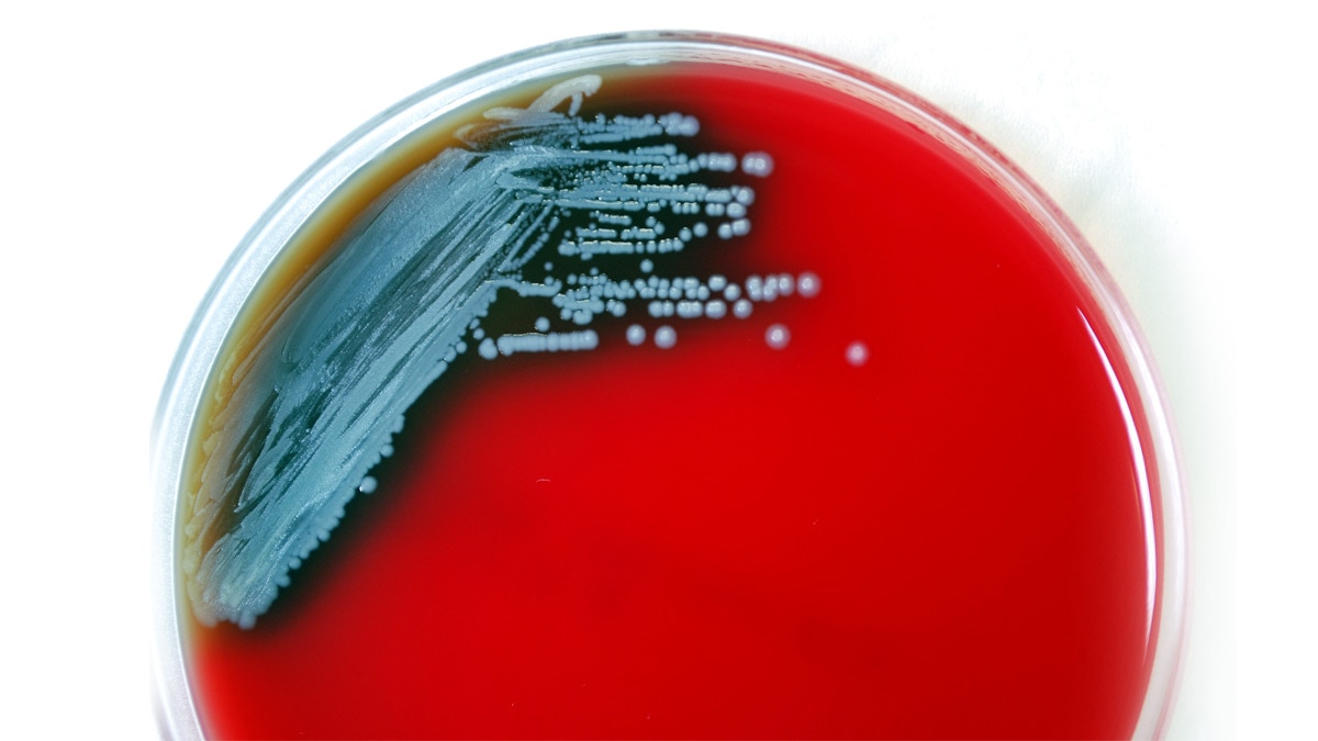 Rare, dangerous bacterium found in US soil: What you need to know - Vimarsana News