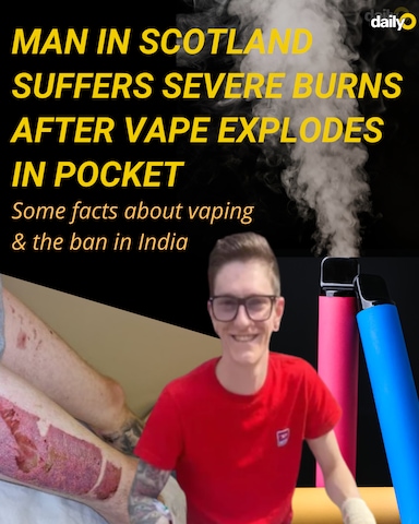 Scotland man suffers severe burns after vape explodes in pocket Scotland man suffers severe burns after vape explodes in pocket
