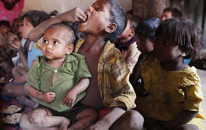 malnourishment_103017010332.jpg malnourishment_103017010332.jpg