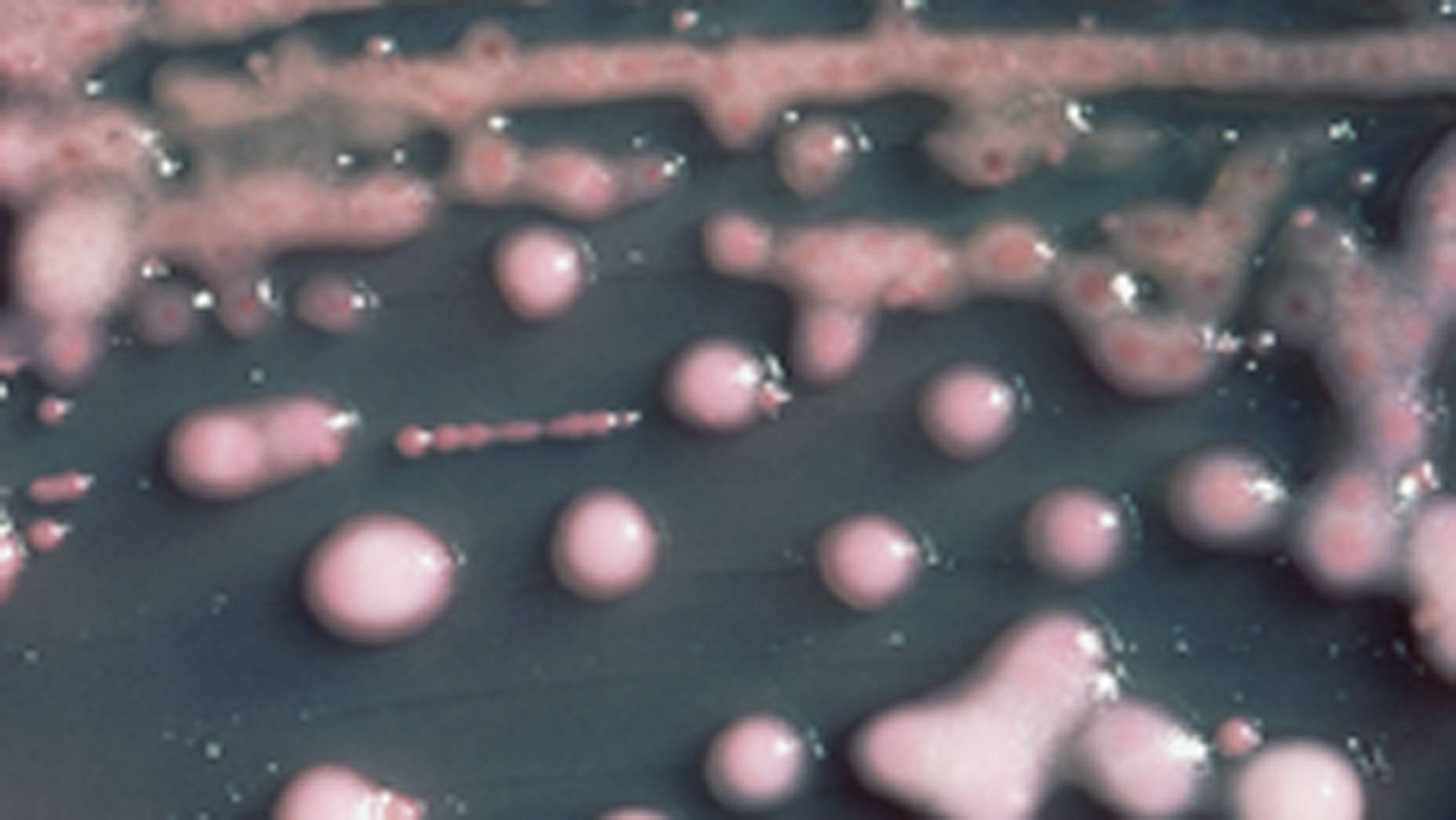 Why US woman dying of bacteria that resisted 26 antibiotics is worrying