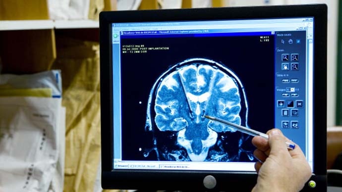 main_brain-gray-matt_062421052346.jpg main_brain-gray-matt_062421052346.jpg