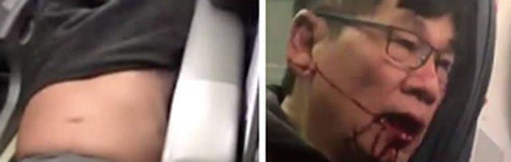 How United Airlines dragged a doctor off plane on his back, mouth bleeding: 15 things to know