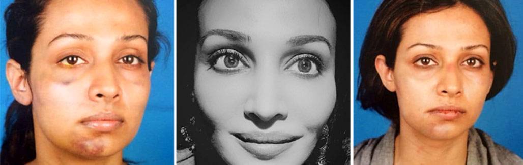 Actress Flora Saini Accuses Producer Gaurang Doshi Of Physical Abuse