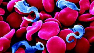 सेक्‍स न करना जानलेवा भी हो सकता है!