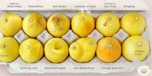 नींबू की ये तस्वीरें बताएंगी ब्रेस्ट कैंसर के बारे में...