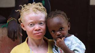 जानवरों की तरह हो रहा है यहां इंसानों का शिकार !