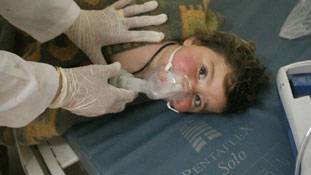 कैमिकल अटैक से बचकर निकले शख्‍स की कहानी जरूर सुननी चाहिए!