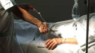 भारत में इच्छा मृत्यु की सामाजिक मान्यता का सवाल