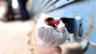 सीलिंग से राहत भूल जाओ