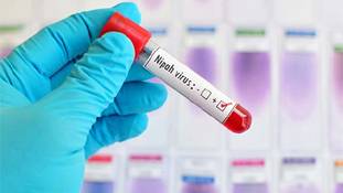 भारत पहुंचे ये 3 जानलेवा वायरस बताते हैं कि हमारा देश कितना आसान 'टारगेट' है !