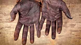 काली या सांवली लड़की देख शादी से इंकार क्यों कर देते हैं, ये हैं वजह