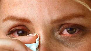 पानी, सूरज, यहां तक कि बैठने से भी एलर्जी...