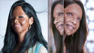 थैंक्यू दीपिका पादुकोण, 'लक्ष्मी' बनने के लिए साहस चाहिए