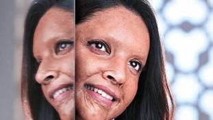 Chhapaak में दीपिका पादुकोण ने box office collection जैसे मुद्दों को बना दिया बेमानी Chhapaak में दीपिका पादुकोण ने box office collection जैसे मुद्दों को बना दिया बेमानी
