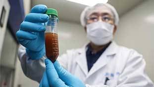 Coronavirus: अमेरिका और चीन के बीच शीत युद्ध शुरू हो चुका है! Coronavirus: अमेरिका और चीन के बीच शीत युद्ध शुरू हो चुका है!