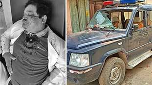 Moradabad में डॉक्टर्स के साथ जो हुआ, उसमें हैरत कैसी?