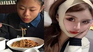 16 साल की लड़की ने 100 बार करवाई प्लास्टिक सर्जरी, सुंदरता की सनक या दबाव?