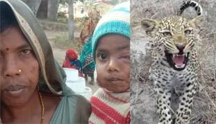 बेटे को तेंदुए के जबड़े से जिंदा छीन लाई एक मां, ममता को प्रणाम कीजिये...