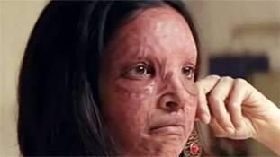 Chhapaak के 2 साल: दीपिका पादुकोण की फिल्म के 5 डायलॉग, जो दिल झकझोर देते हैं!