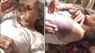 पत्नी की शर्त मानकर बूढ़ी मां को बुरी तरह पीटने वाले बेटे के बारे में आप क्या कहेंगे?