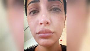 दिखावे की दुनिया में सोशल मीडिया पर श्रुति हासन की ईमानदारी ने दिल जीत लिया