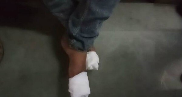 injured foot