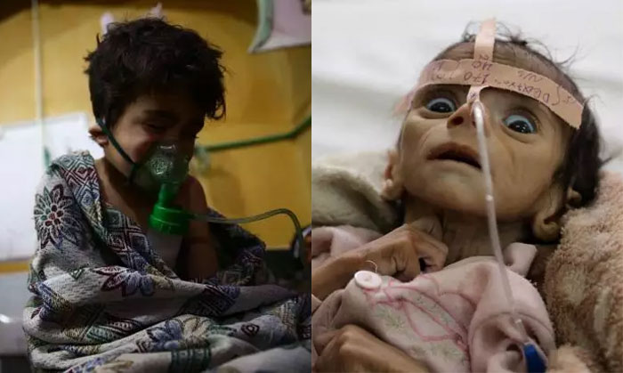 बाईं तरफ की तस्वीर में जो बच्चा है, वो सीरिया का है. दाहिनी तरफ वाला बच्चा यमन का है. कोई इंसानियत की बात करे, तो कैसे कहेगा कि उसे एक बच्चे के लिए दर्द होता है और दूसरे के लिए नहीं.