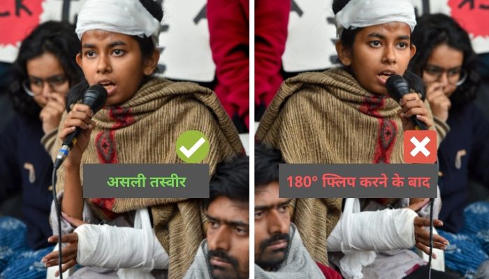 हमने एक ही तस्वीर को दो तरह से दिखाया है. असली तस्वीर में दिख रहा है कि आइशी का दाहिना हाथ टूटा है. लेकिन जब फोटो को 180 डिग्री पलटने पर बिल्कुल उलट तस्वीर बन गई.