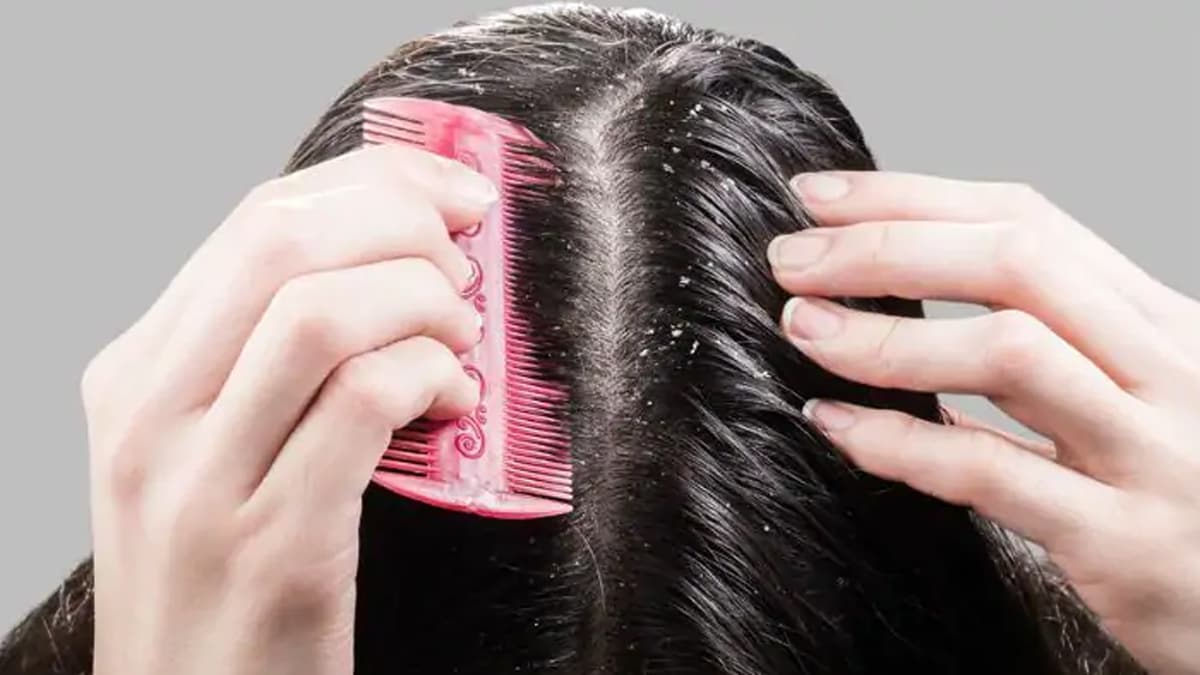 Health tips : किसी भी एंटी-डैंड्रफ शैम्पू का उपयोग करने से पहले इन 5 कारकों को जान लें, आप अभी Health tips : किसी भी एंटी-डैंड्रफ शैम्पू का उपयोग करने से पहले इन 5 कारकों को जान लें, आप अभी