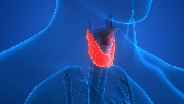 Thyroid Cancer 1 Thyroid Cancer 1