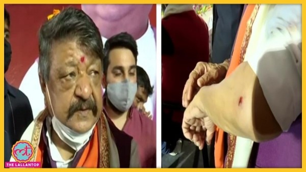 कैलाश विजयवर्गीय की कार के सबसे ज्याद नुकसान हुआ और उन्हें हमले में चोटें भी आईं. Sale(632)