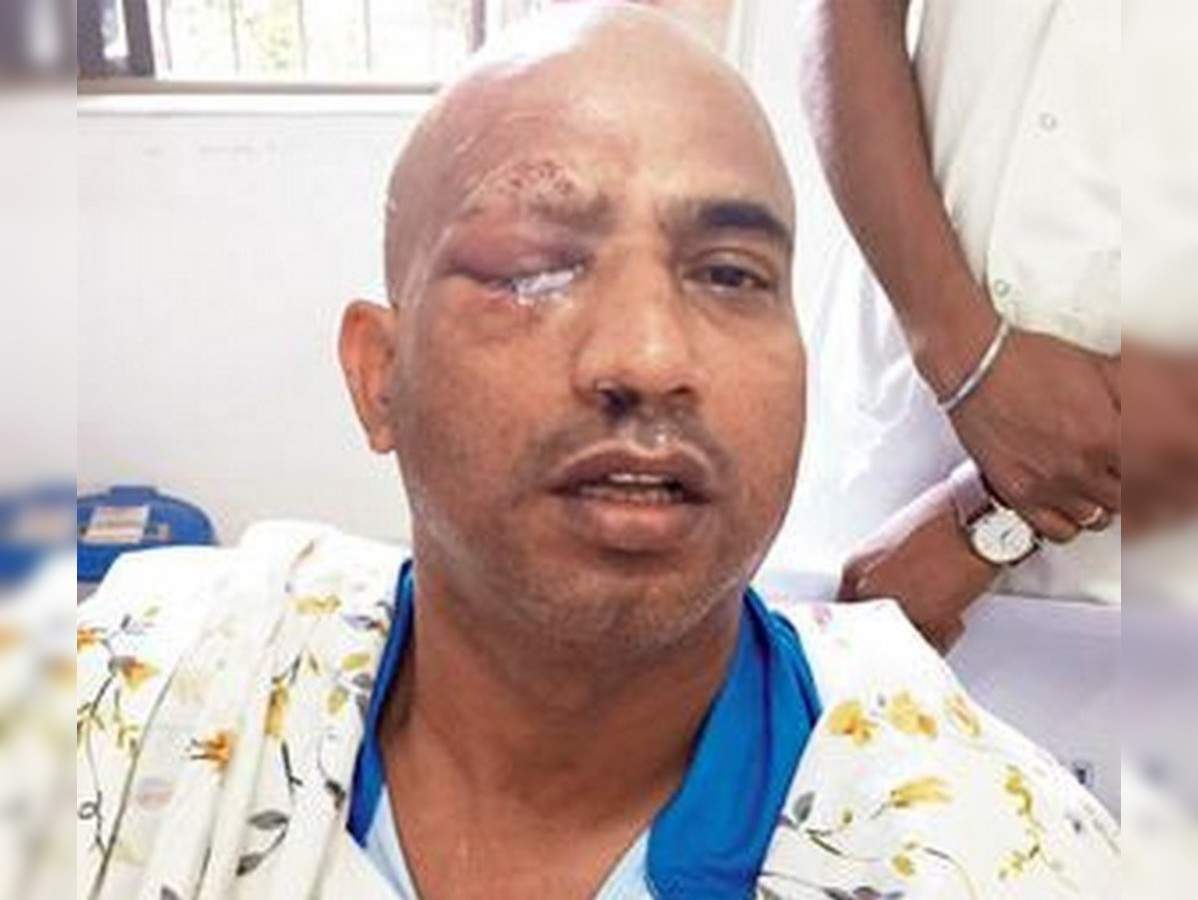 हमले के बाद जीतू अपनी आंख तक खो सकते थे. Jeetu Verma Eye Injury