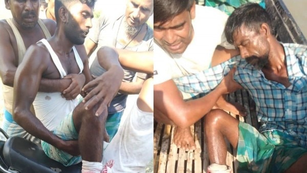 हिंसा में घायल लोग. (तस्वीरें- आजतक/इंडिया टुडे) assam