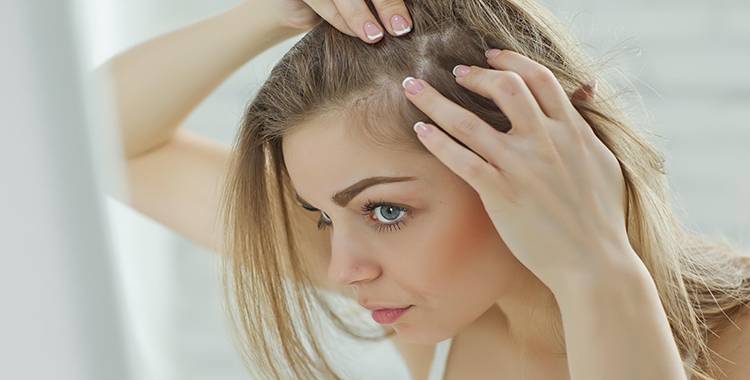 5 home remedies for dandruff you need to try now! 5 home remedies for dandruff you need to try now!