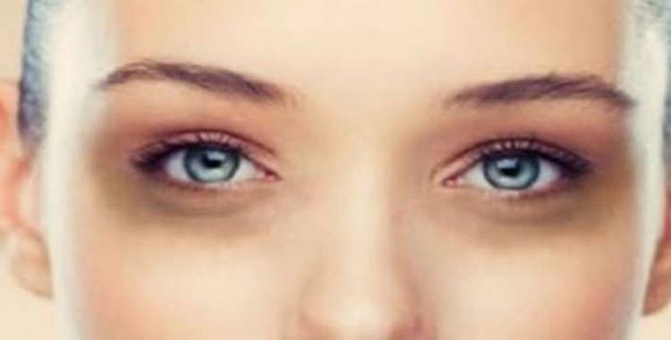 5 Home remedies that will help you to get rid of dark circles 5 Home remedies that will help you to get rid of dark circles