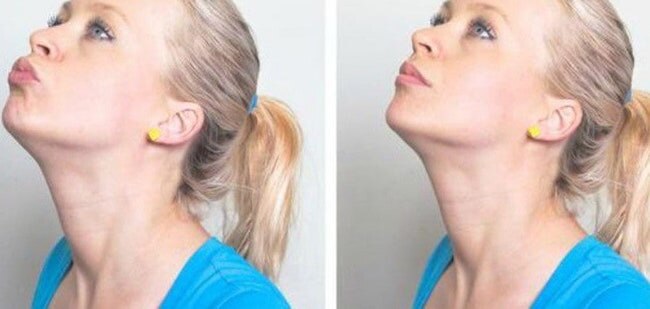 Follow These 5 Simple Exercises To Get A Perfect Jawline