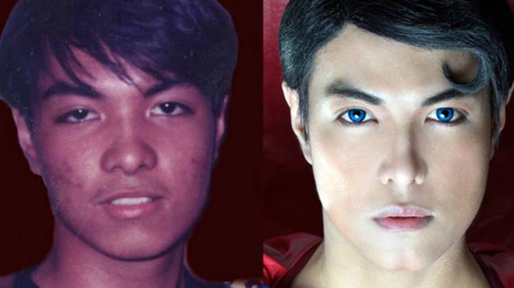 Herbert Chavez underwent 15 years of surgery to look like the Superman
