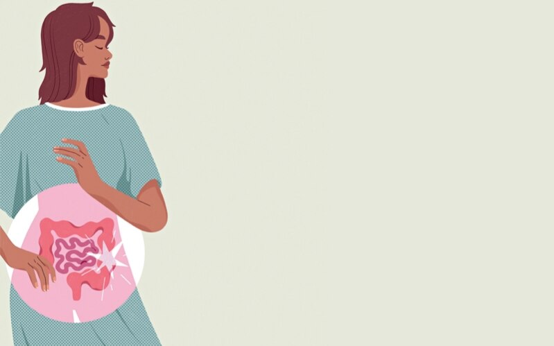 Who's Getting Colon Cancer?